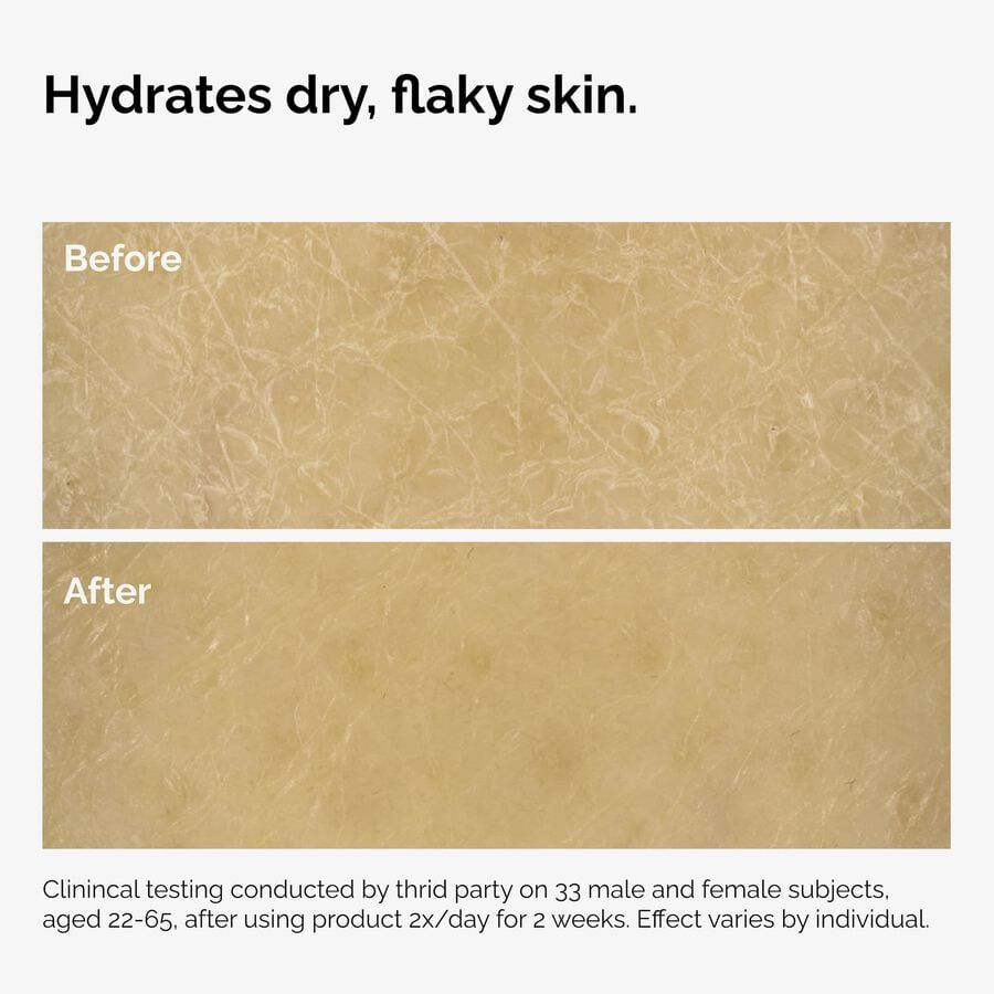 the-body-care-collection-j0 ord-natural-moisturizing-factors-inulin-body-before-after-graphic-02.jpg
